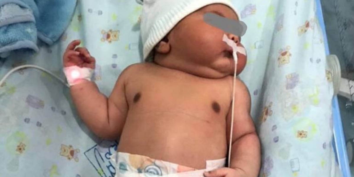 Caracol Radio Bebé 'gigante' que nació en Ciénaga, Magdalena.