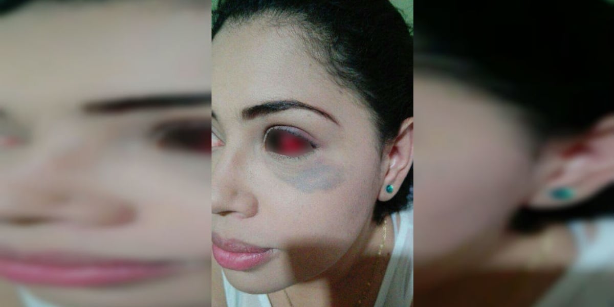 Cortesía Ana Jiménez resultó visiblemente afectada por la golpiza.