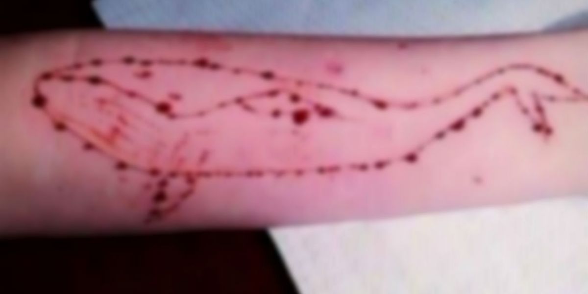 Redes sociales El polémico juego lleva a los adolescentes a herirse a sí mismos.