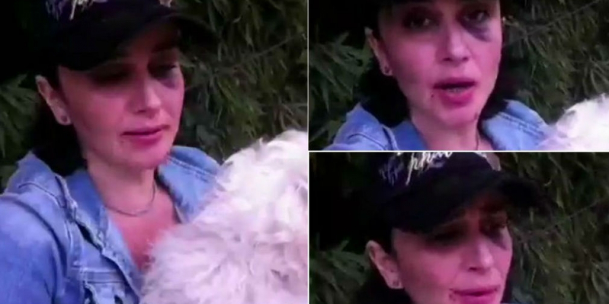 Captura de pantalla. Tania Robles sufrió varias heridas en su rostro.