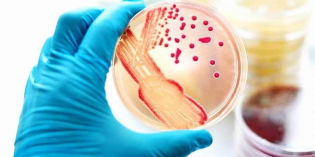 Archivo La gonorrea afecta a más de 70 millones de personas en el mundo.