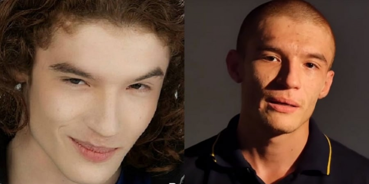 Pulzo Óscar Naranjo.