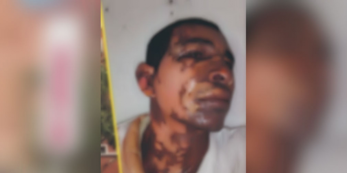Al Día Pedro José Vanegas Jiménez fue atendido en el Hospital Fernando Troconis.
