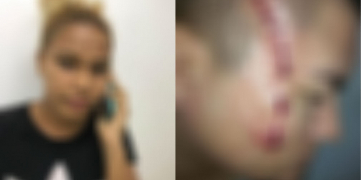 Redes sociales Las imágenes, según el coronel Samir Pava, corresponden a un accidente y no a protestas por cierre de campaña.