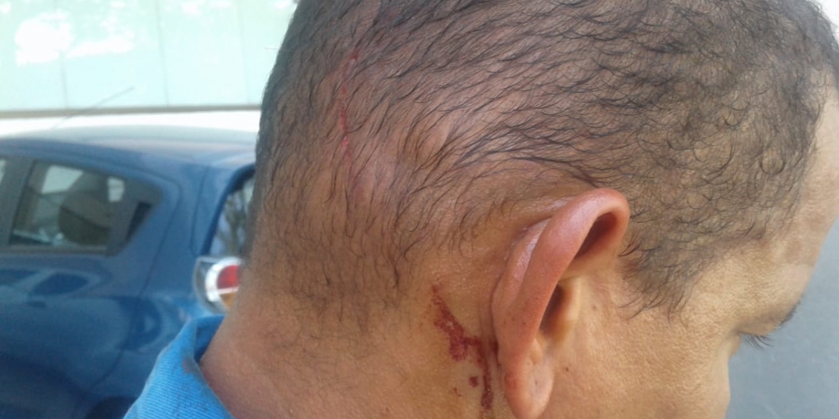 Electricaribe Trabajador de la empresa de energía eléctrica fue agredido mientras laboraba