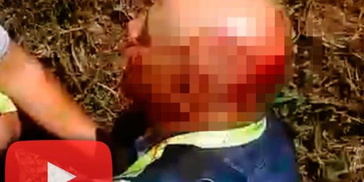 Captura video suministrado- Blu Radio Agente de tránsito agredido en medio de procedimiento