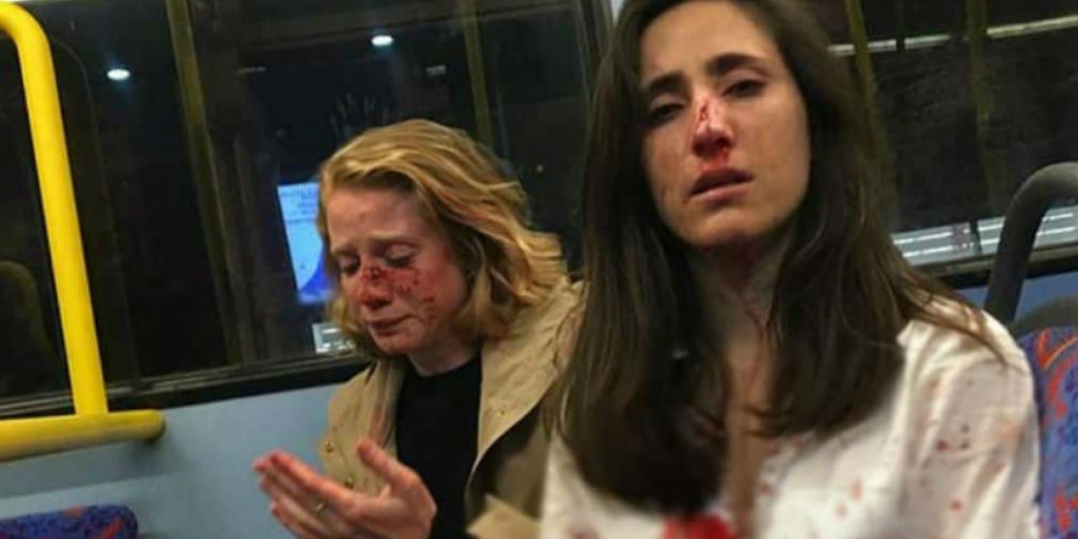 cortesía  Paliza recibida por las mujeres en ataque homofóbico.