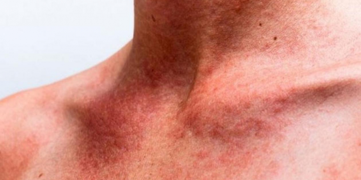 EFE Imagen para ilustrar nota.