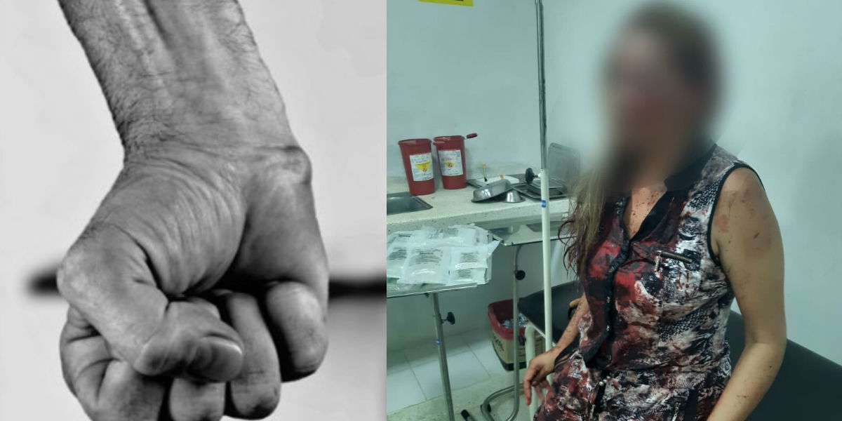 eldiario.com.co - Heyner Escobar La mujer presenta varias lesiones en su cuerpo.