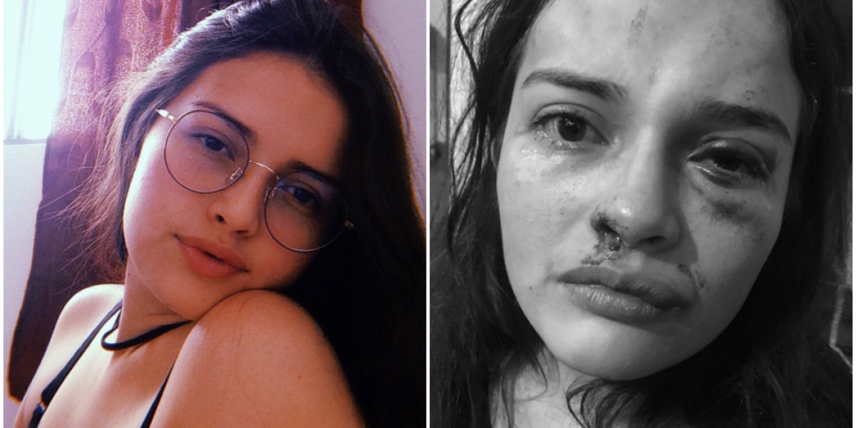 Camila Godoy, joven de 18 años que fue agredida brutalmente por su madre y su padrastro. cortesía