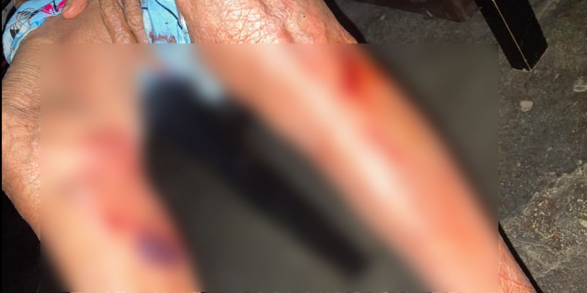 Foto publicada por la nieta de la víctima en Facebook, en donde muestra las heridas producto de la agresión.