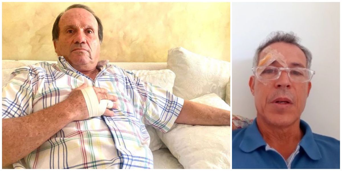 Caracol Radio - Cortesía Mono Abello apareció con la mano lastimada, del golpe que asegura le dio a Camilo Dávila.