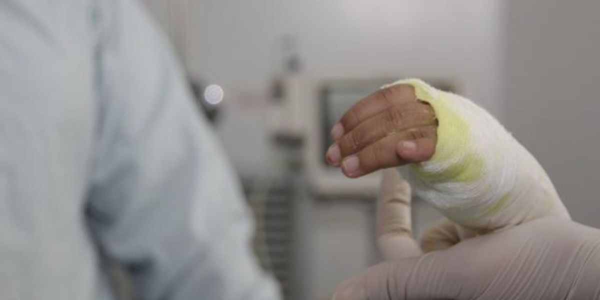 Seguimiento Quemados por pólvora en Colombia.