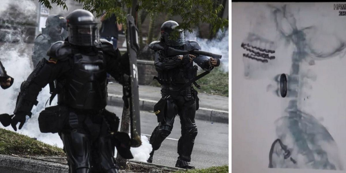 Seguimiento Agente del Esmad.