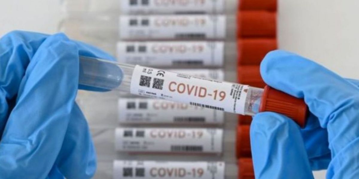 Casos de coronavirus en el Magdalena.