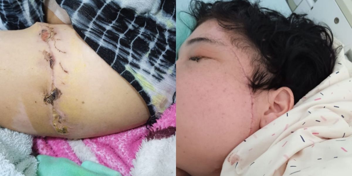 Seguimiento. Agresiones recibidas por Yermaní.