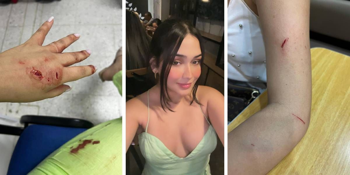 Cortesía Daniela Gualteros, agredida durante el día de Amor y Amistad