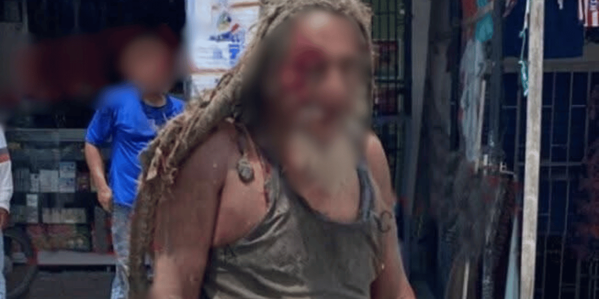 Cortesía ‘El Purry’, habitante de calle, resultó gravemente herido tras ser atropellado en Ciénaga