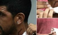 Reiner Hurtado, venezolano herido.