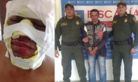 Uno de los policías quemados y el capturado.