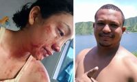 Silene Quintero, mujer que denunció ser víctima de violencia intrafamiliar