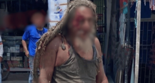‘El Purry’, habitante de calle, resultó gravemente herido tras ser atropellado en Ciénaga
