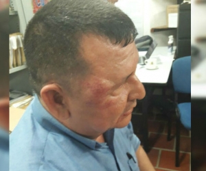 El operario José Osorio fue golpeado. 