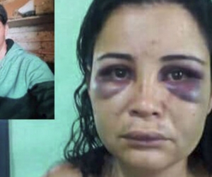 Lina Andrea Aguirre, la mujer golpeada salvajemente por su expareja Pedro Rojas.