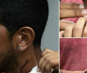 Reiner Hurtado, venezolano herido.