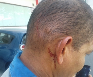 Trabajador de la empresa de energía eléctrica fue agredido mientras laboraba