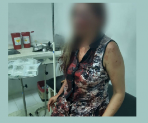 Elizabeth Montealegre Hernández fue la mujer brutalmente agredida.