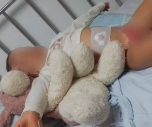 El bebé de 18 meses sigue en recuperación tras la quemadura sufrida.