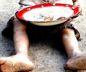 Los casos de desnutrición en el departamento del Magdalena son más frecuentes en los municipios de la zona norte.