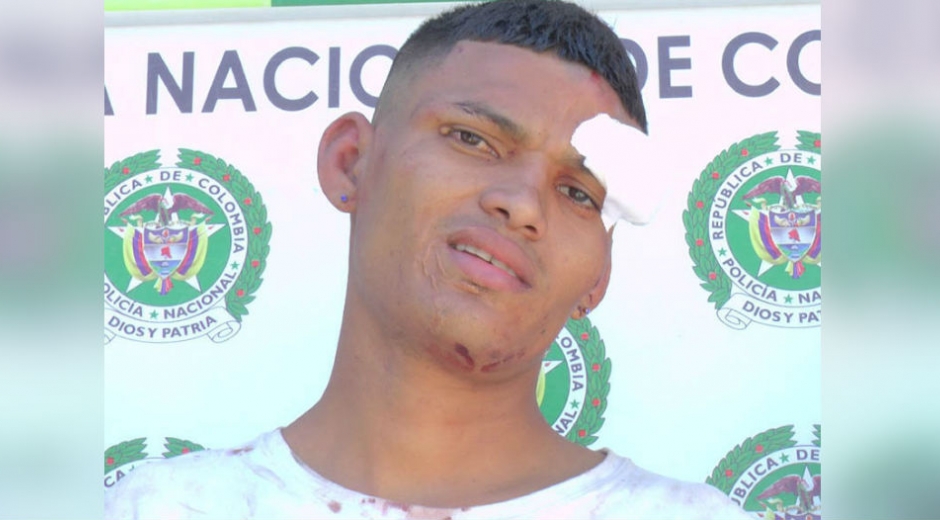 Ignacio José Acosta, alias ‘Nachito’.
