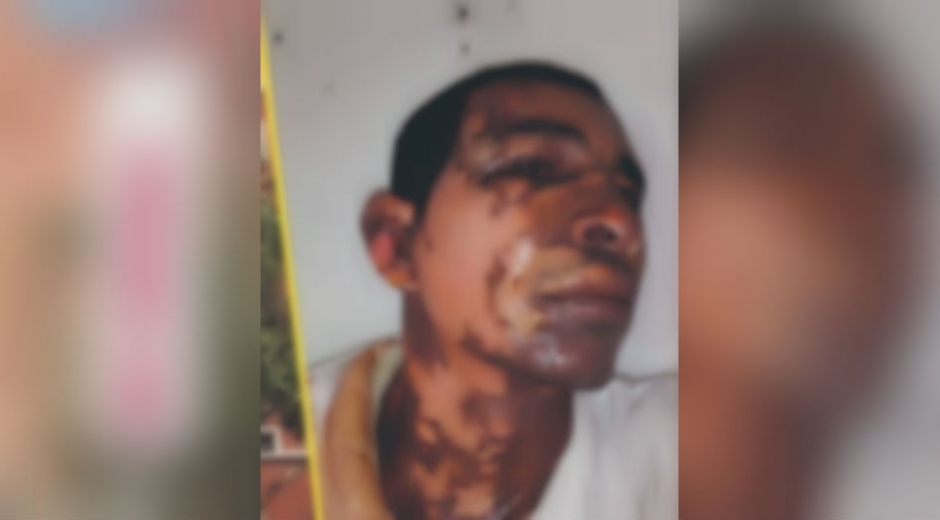 Pedro José Vanegas Jiménez fue atendido en el Hospital Fernando Troconis.