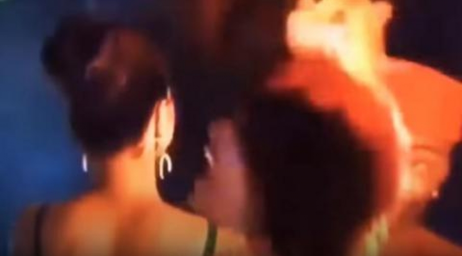 Los efectos pirotécnicos en el escenario le incendiaron su cabello.