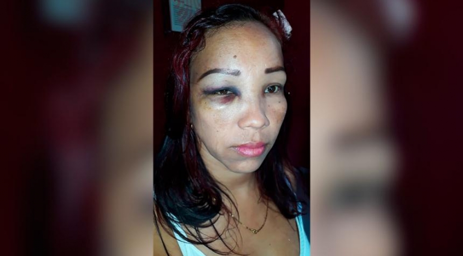 El Heraldo Cindy Aguilera, mujer agredida
