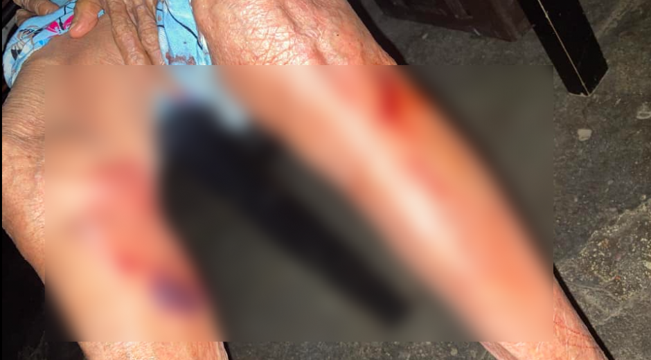 Foto publicada por la nieta de la víctima en Facebook, en donde muestra las heridas producto de la agresión.