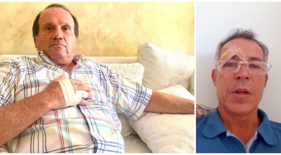 Caracol Radio - Cortesía Mono Abello apareció con la mano lastimada, del golpe que asegura le dio a Camilo Dávila.