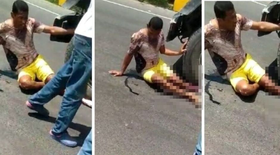 Henry Gómez, quien se debate entre la vida y la muerte