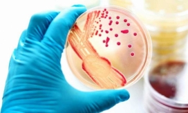 La gonorrea afecta a más de 70 millones de personas en el mundo.